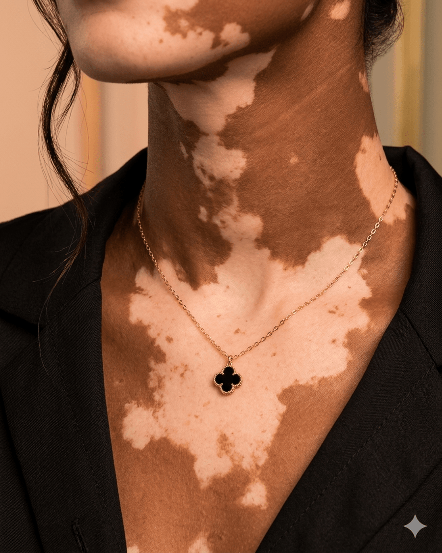 Collares